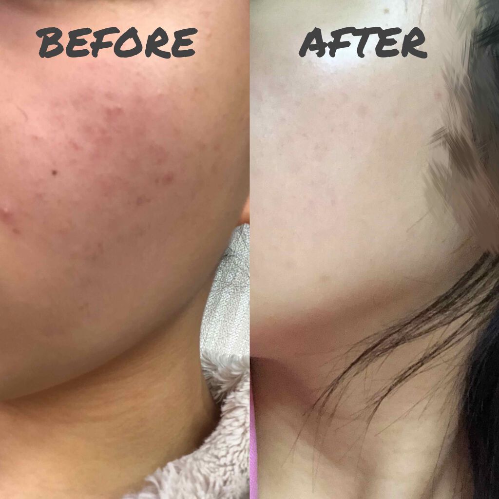 ハトムギ保湿ジェル(ナチュリエ スキンコンディショニングジェル)/ナチュリエ/美容液を使ったクチコミ(2枚目)