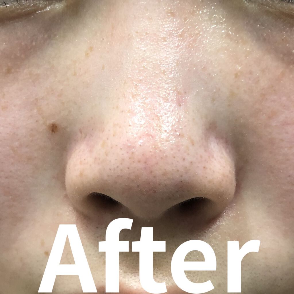 ガスール固形/ナイアード/洗顔石鹸を使ったクチコミ（2枚目）