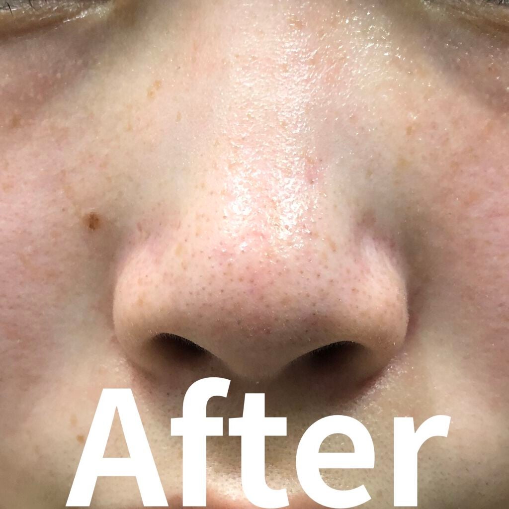 ガスール固形/ナイアード/洗顔石鹸を使ったクチコミ(2枚目)