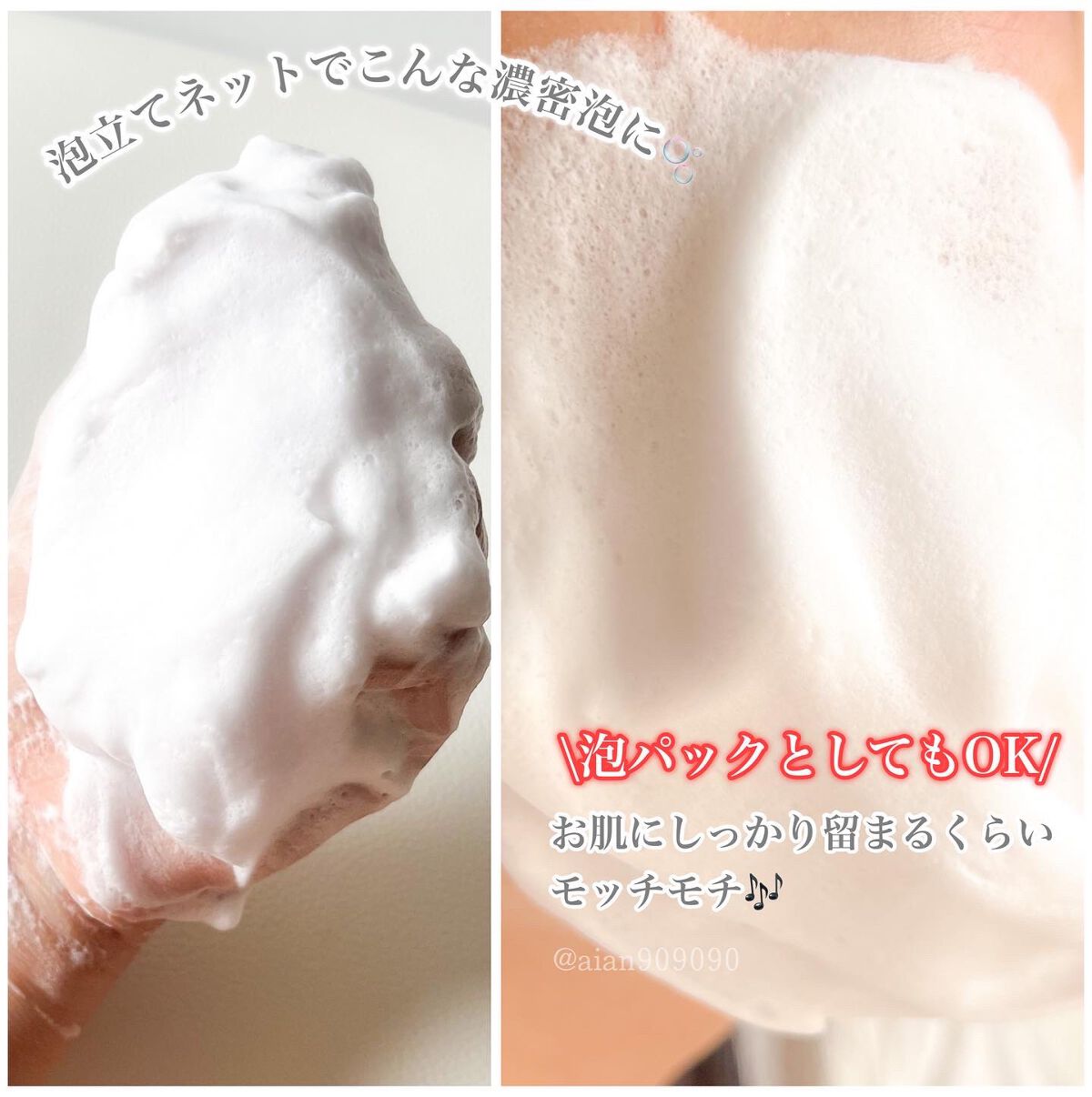 スキンピールバー ティートゥリー/サンソリット/洗顔石鹸を使ったクチコミ（2枚目）