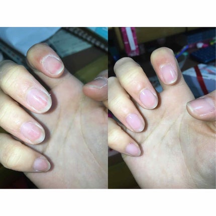 ディーアップファンデーション/D-UP/ネイルベースコートを使ったクチコミ(2枚目)