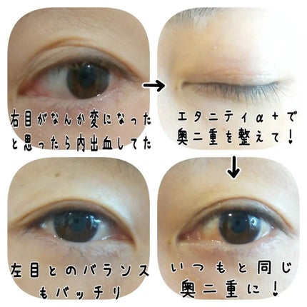 ETERNITY LINE α+/Girl's Maker/二重まぶた用アイテムを使ったクチコミ(4枚目)