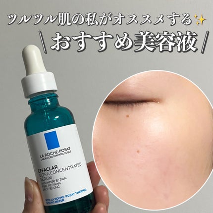 エファクラ ピールケア セラム/ラ ロッシュ ポゼ/美容液を使ったクチコミ(1枚目)