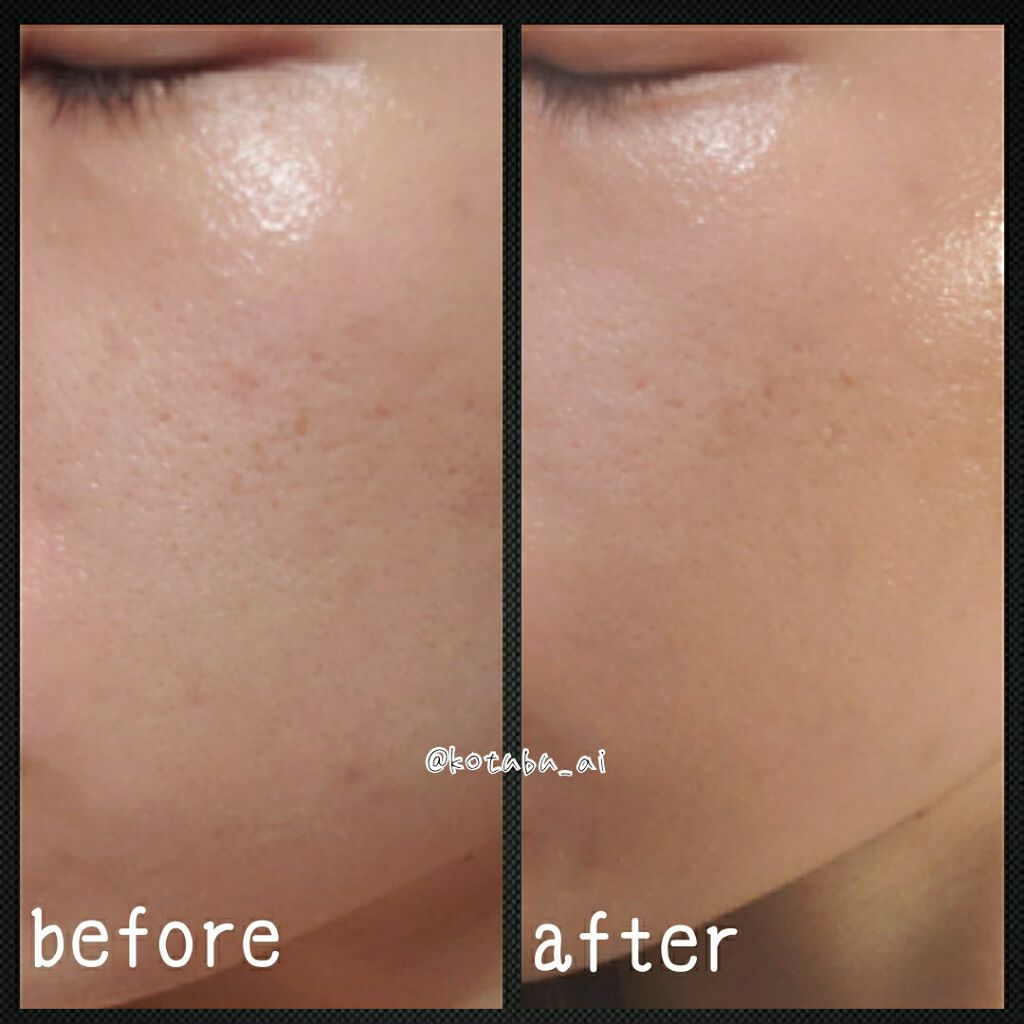 アンブリオリス モイスチャークリーム/アンブリオリス/フェイスクリームを使ったクチコミ(2枚目)