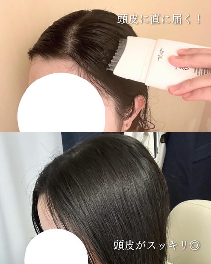 グローターン 100ml/リリーイブ/頭皮ローションを使ったクチコミ(4枚目)