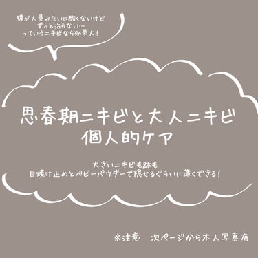 大学受験で寝不足＆ストレスで肌荒れが酷いことになったので個人的に効いたスキンケアを共有したいと思います！

使用したものは商品のところに追加しておくので、気になったものがあればぜひ使ってみてください。私