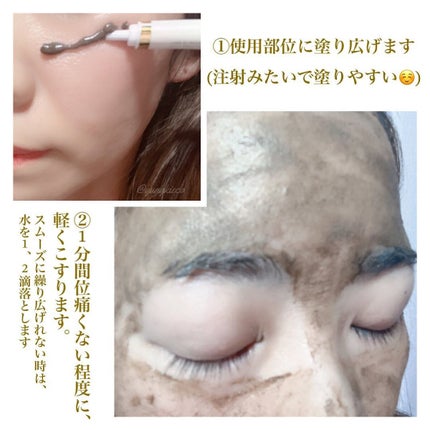 ダーマスキンピーリング/BQCELL/その他キットセットを使ったクチコミ(2枚目)