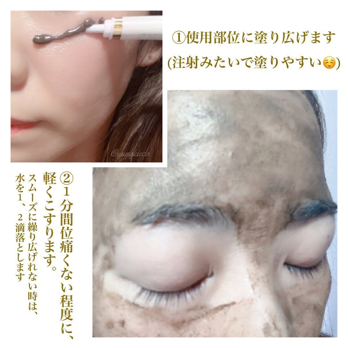 安全 ダーマスキンピーリング⭐︎カンナムドール⭐︎BQCELL