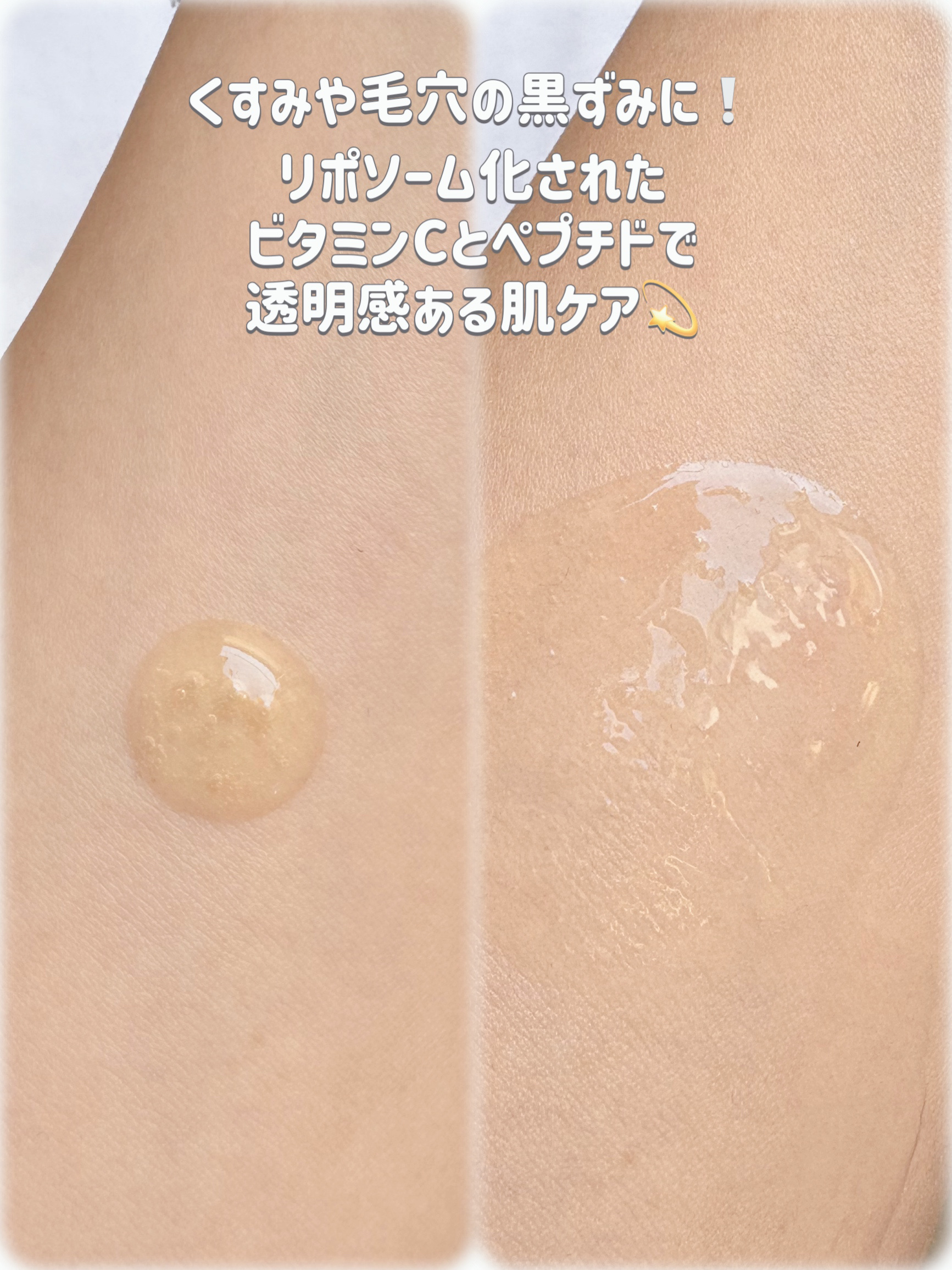 レチ二オールポアタイトニングセラム/Real Barrier/美容液を使ったクチコミ（2枚目）