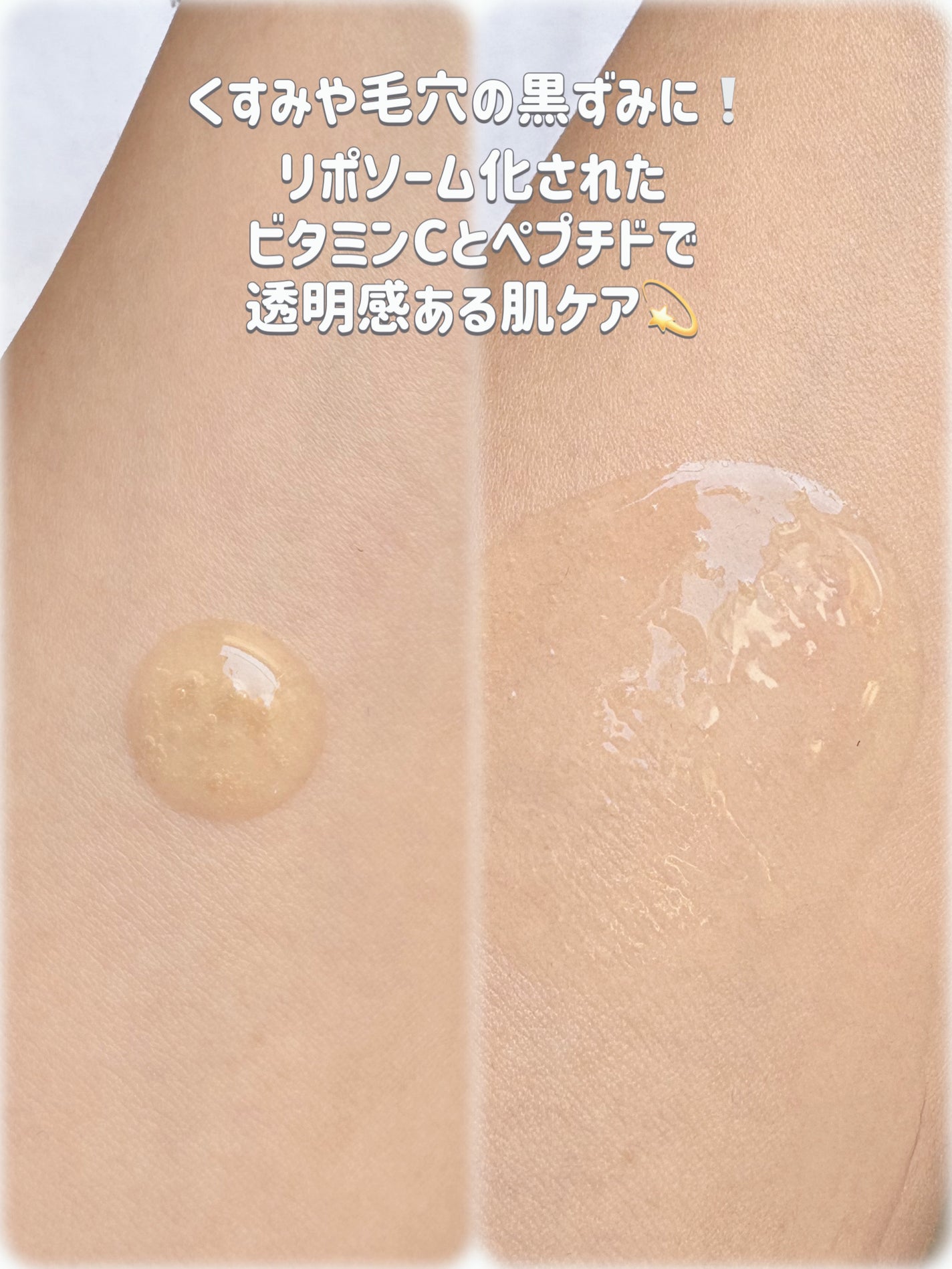 レチ二オールポアタイトニングセラム/Real Barrier/美容液を使ったクチコミ(2枚目)