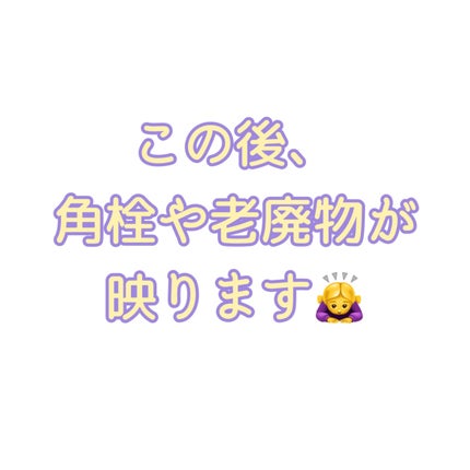 薬用クリアケアスポットエッセンス/無印良品/美容液を使ったクチコミ(3枚目)