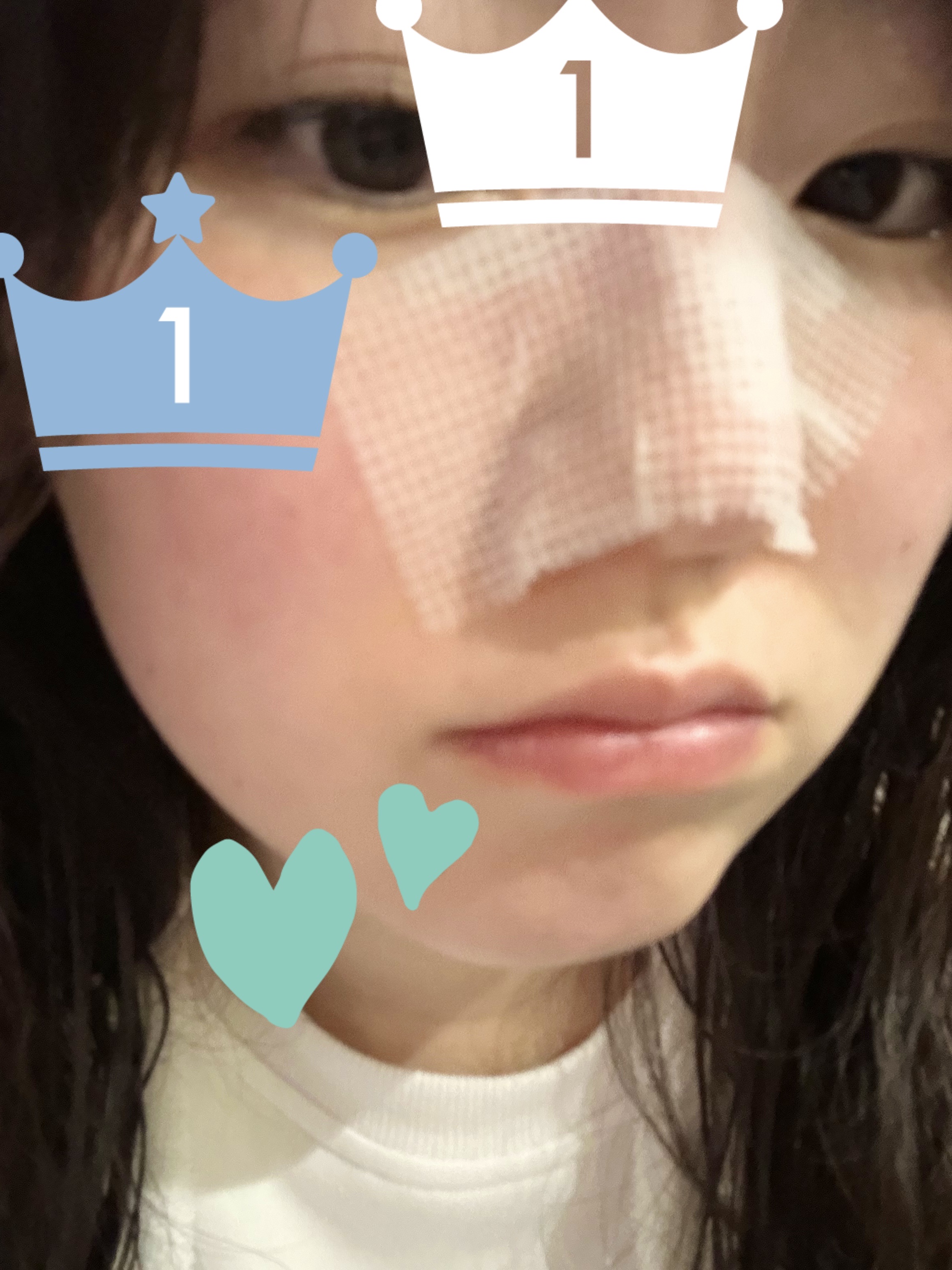 BHクリアノーズパック EX/CucuporeC/シートマスク・パックを使ったクチコミ（3枚目）