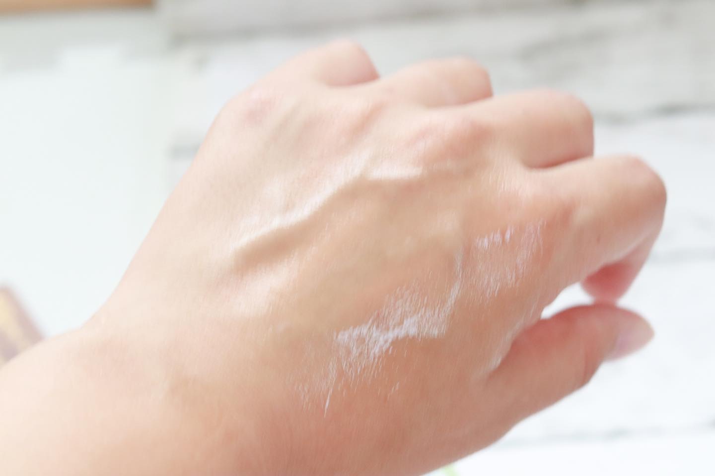 ニキビあとケアジェル/アットノン/その他スキンケアを使ったクチコミ（3枚目）