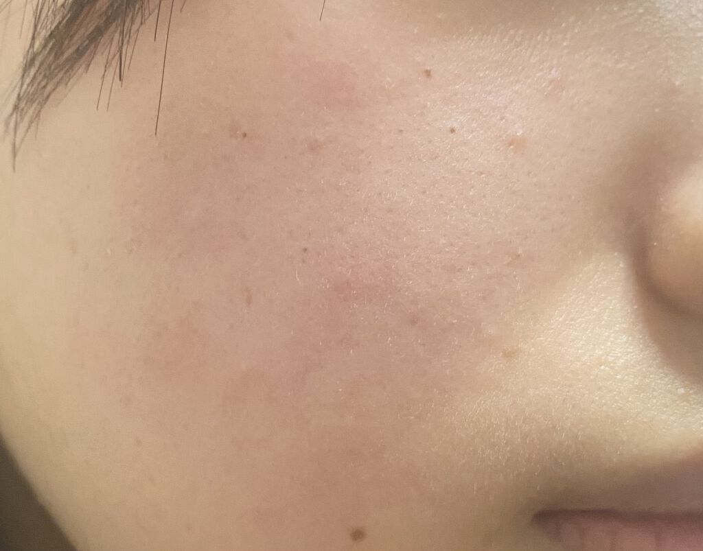 ソフティモ 薬用ホワイト クレンジングウォッシュ/ソフティモ/洗顔フォームを使ったクチコミ（2枚目）