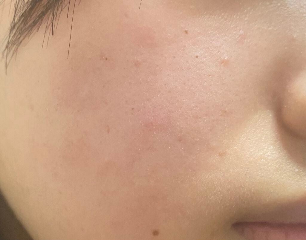 ソフティモ 薬用ホワイト クレンジングウォッシュ/ソフティモ/洗顔フォームを使ったクチコミ(2枚目)