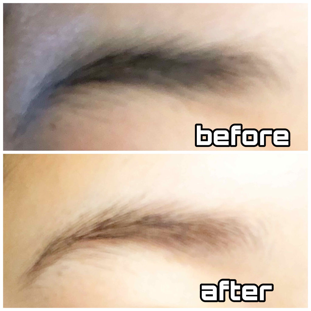 脱色クリーム スピーディー/エピラット/ムダ毛ケアを使ったクチコミ（2枚目）