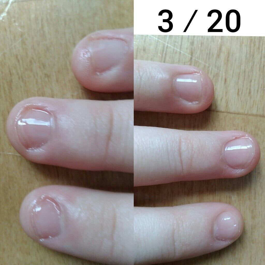 オリジナル ピュアスキンジェリー/ヴァセリン/ボディクリームを使ったクチコミ(4枚目)