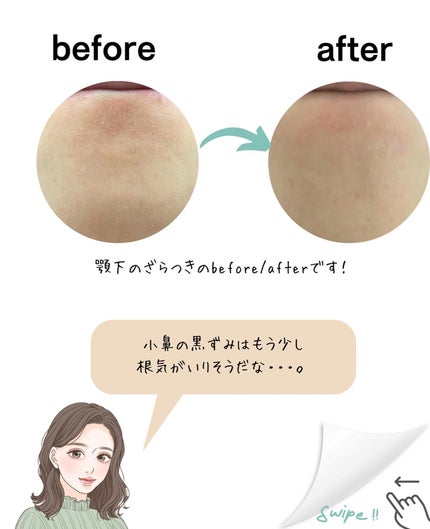 チョコブラ スペシャル毛穴ケアセット/Chocobra/スキンケアキットを使ったクチコミ(5枚目)