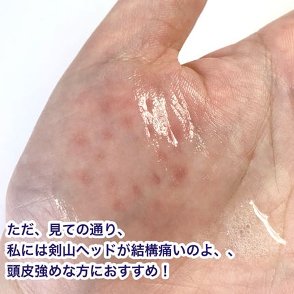 ワンダーハニー フローズンヘッドジェット/VECUA Honey/頭皮ローションを使ったクチコミ(6枚目)