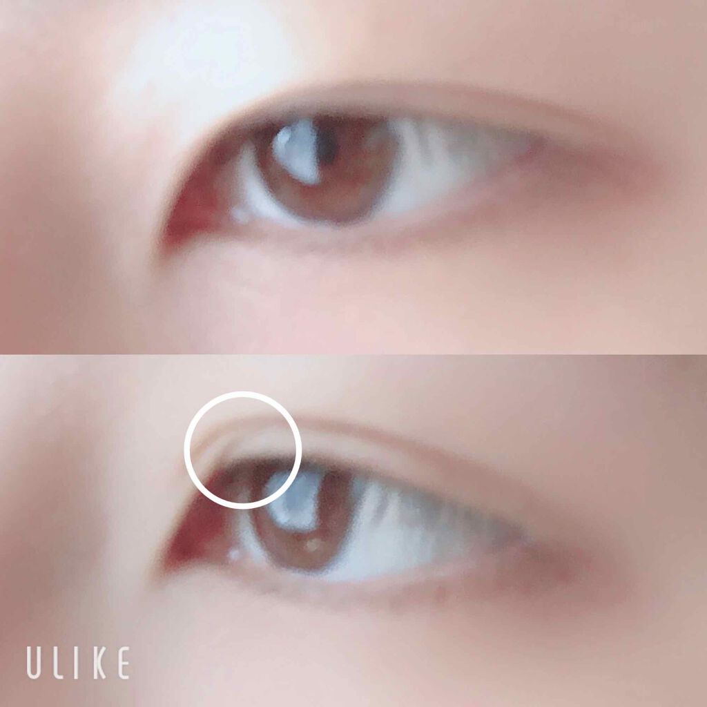 のびるアイテープ/セリア/二重まぶた用アイテムを使ったクチコミ（2枚目）