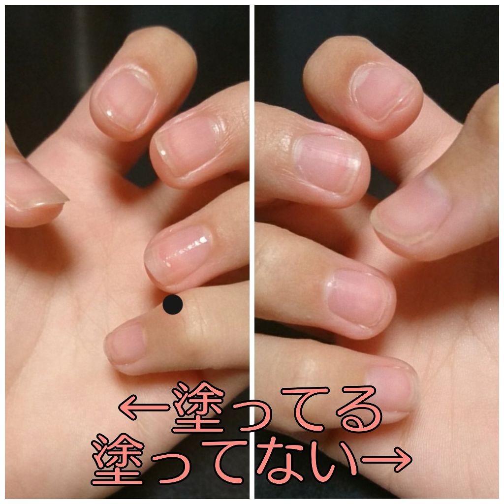 ネイルサポート ピンク/ネイルネイル/ネイルベースコートを使ったクチコミ(4枚目)