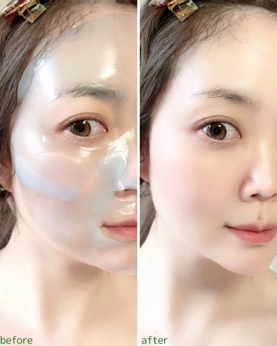 レチA リードルショット100 2ステップハイドロゲルマスク/VT/シートマスク・パックを使ったクチコミ(6枚目)