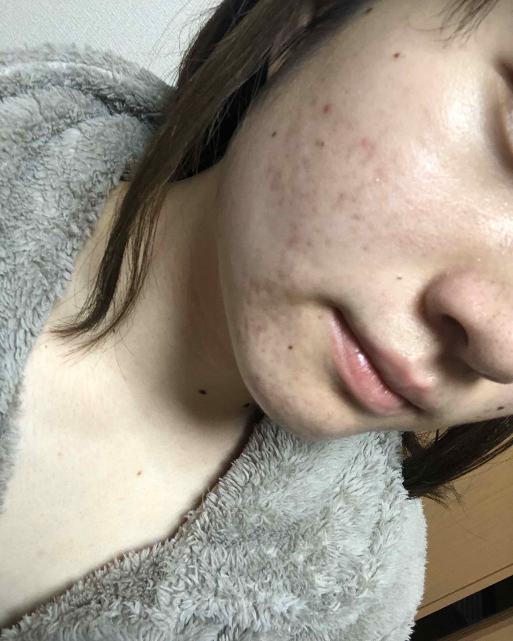 マンスリースキンケアプログラム(旧)/APEX/スキンケアキットを使ったクチコミ(3枚目)