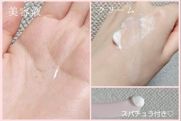 バイタル アップ ミルク モイスチャー/綾花/乳液を使ったクチコミ（4枚目）