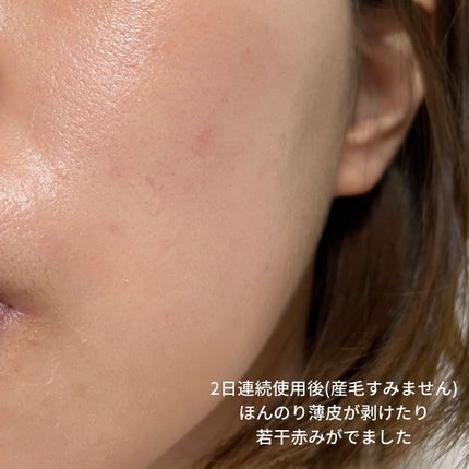 RXザ・レチノール0.1クリーム/COSRX/フェイスクリームを使ったクチコミ(5枚目)