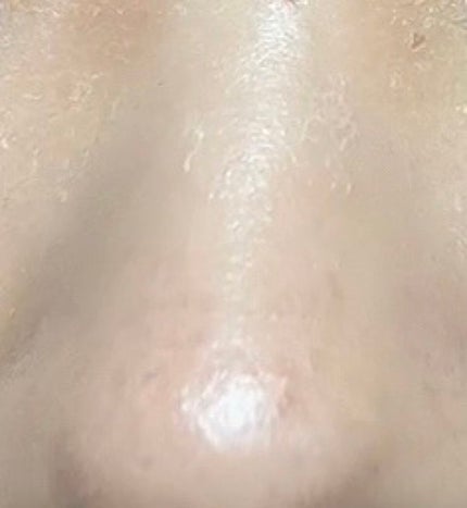 しっとり毛穴ケアクレンジングバーム/ダヴ/クレンジングバームを使ったクチコミ(3枚目)