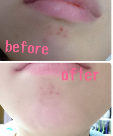 薬用しみ対策美白ジェル/メラノCC/フェイスクリームを使ったクチコミ(3枚目)