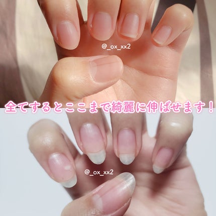 デイケアオイル/Dr.Nail/ネイルオイル・トリートメントを使ったクチコミ(5枚目)