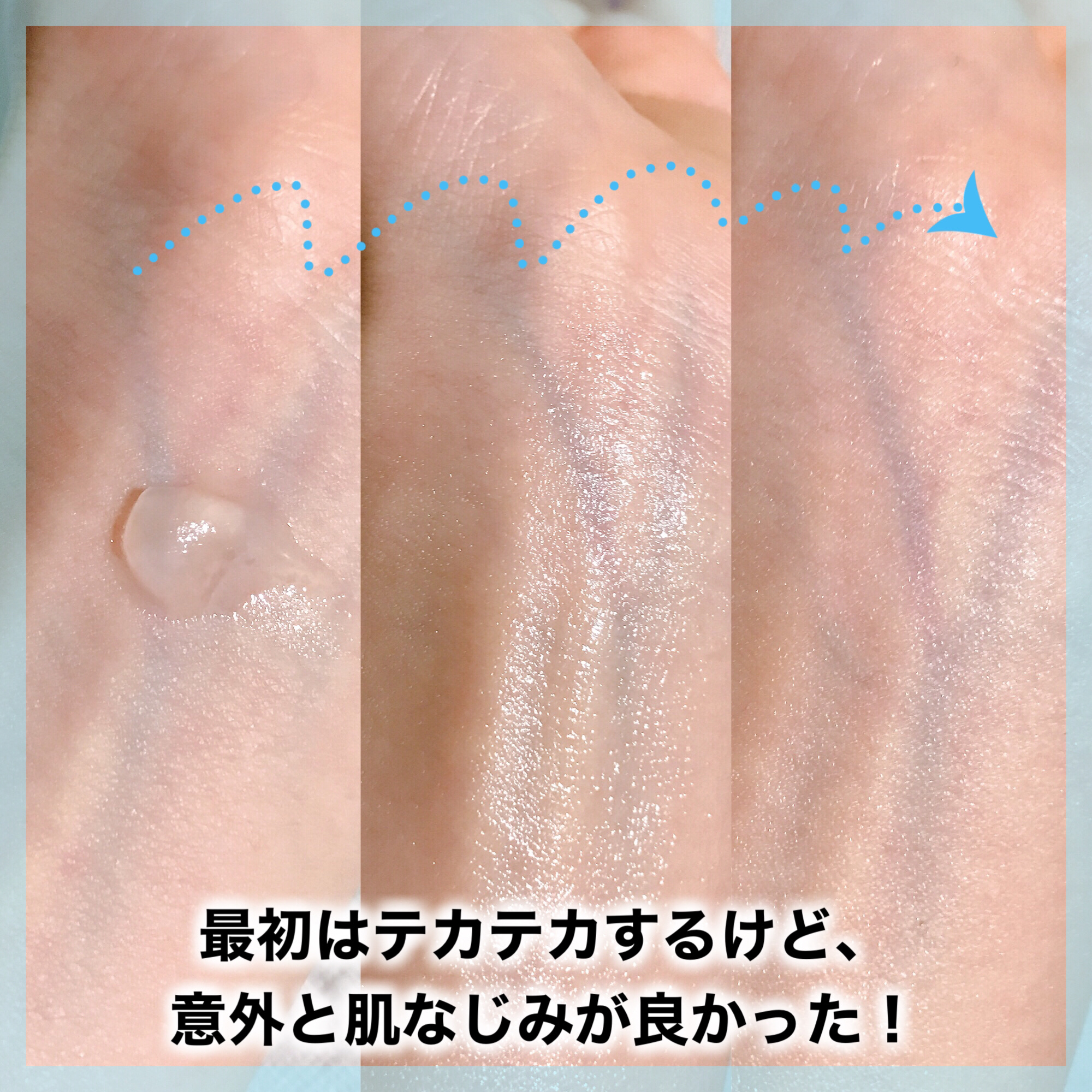 ピュアベール(医薬品)/プロペト/その他を使ったクチコミ（2枚目）