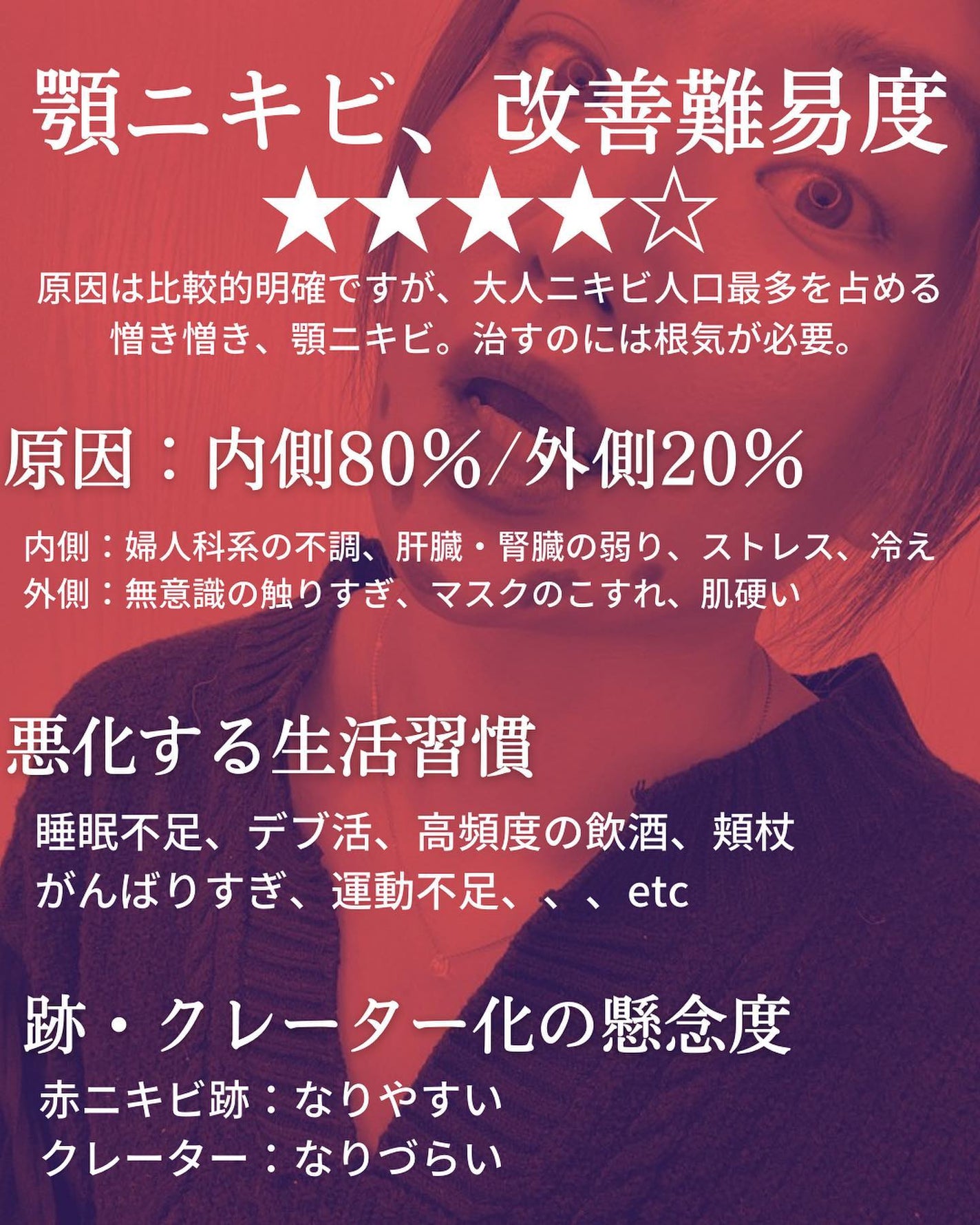 おゆみ|ニキビ・ニキビ跡ケア on LIPS 「【シリーズ①部位別ニキビ改善ルーティン 永遠の宿敵・アゴニキビ..」(2枚目)
