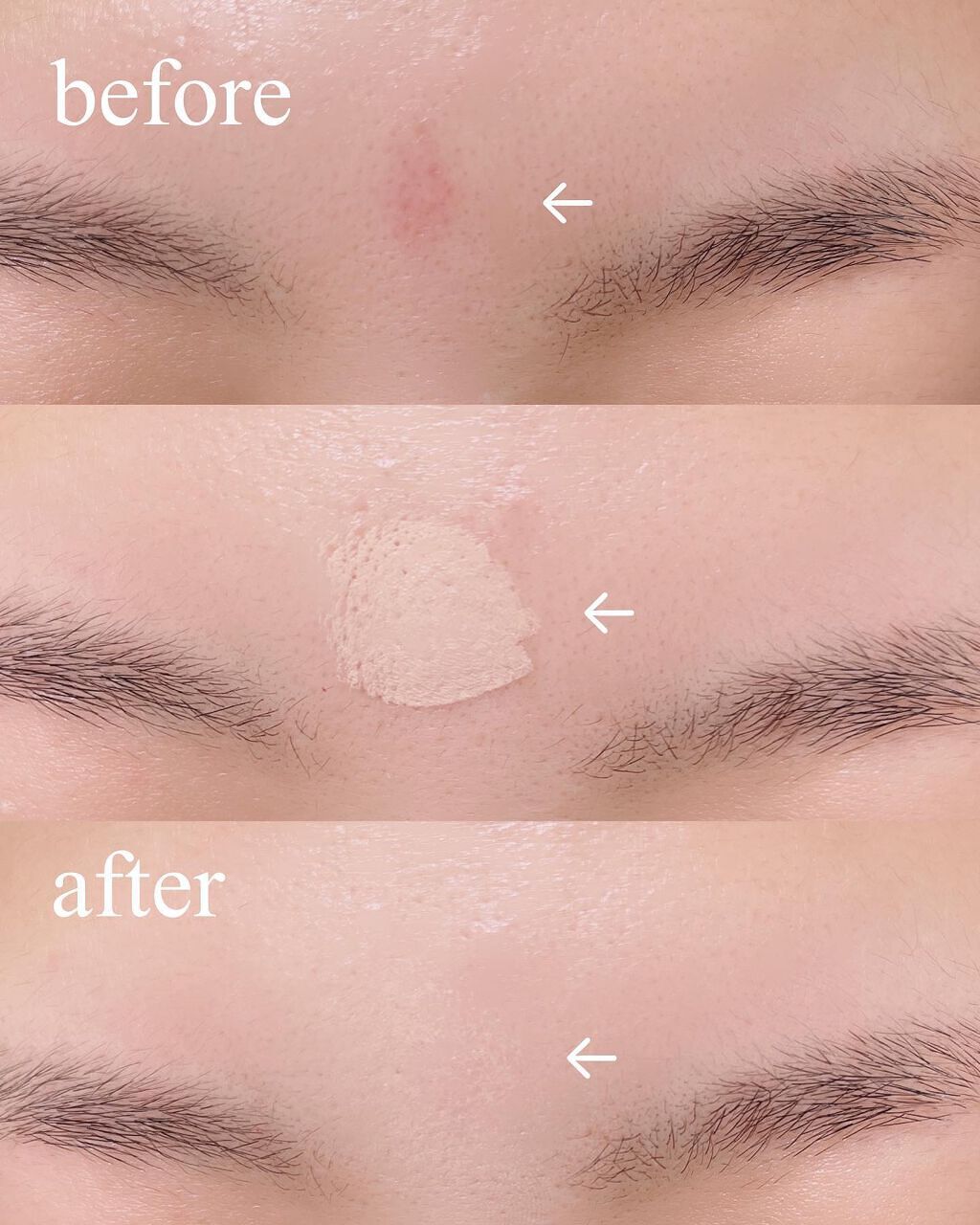 マスクフィットオールカバーデュアルコンシーラー/TIRTIR(ティルティル)/コンシーラーを使ったクチコミ(2枚目)