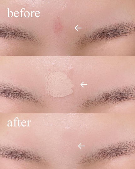 マスクフィットオールカバーデュアルコンシーラー/TIRTIR(ティルティル)/コンシーラーを使ったクチコミ(2枚目)