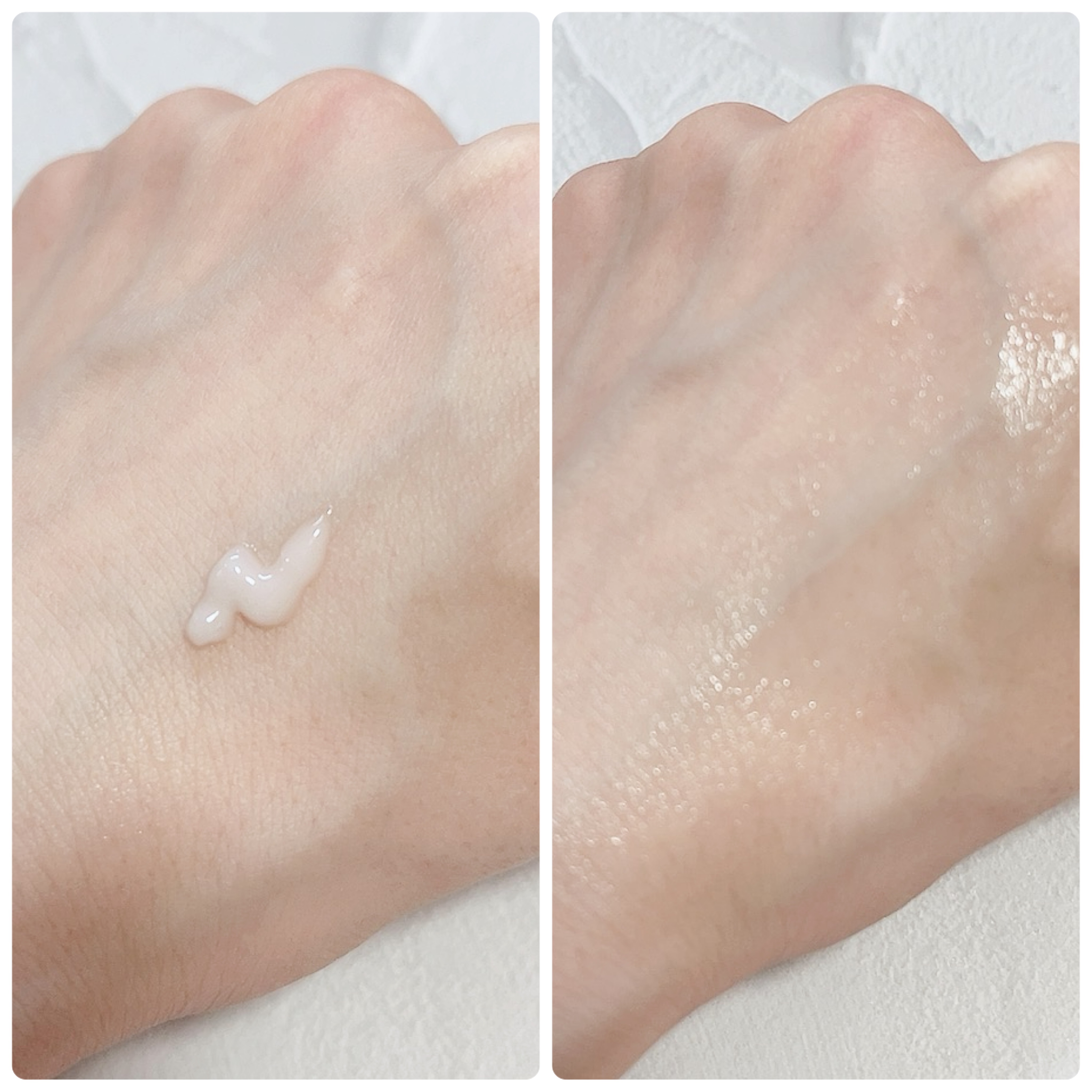 エーキュアスピキュールスポット/obsero/フェイスクリームを使ったクチコミ（3枚目）