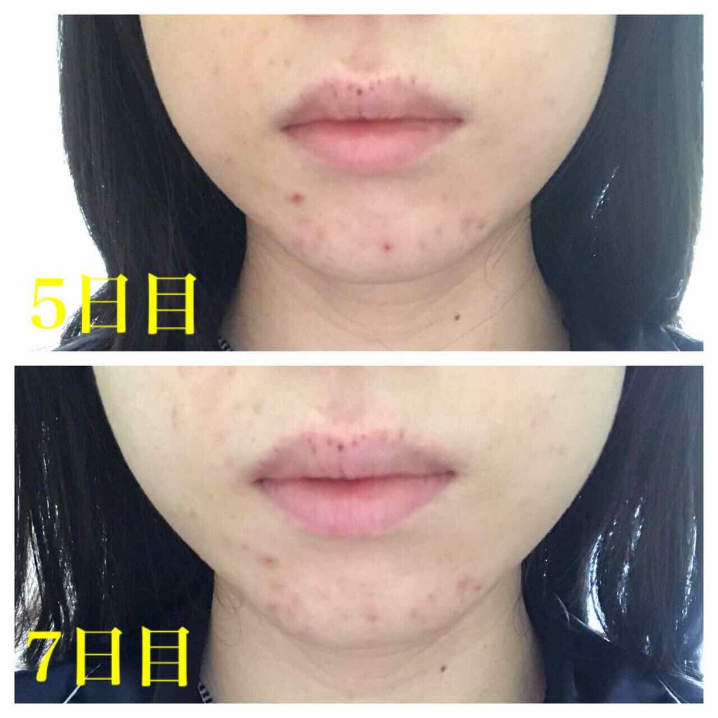 ファイバーフォーム/ルナメアAC/洗顔フォームを使ったクチコミ(3枚目)