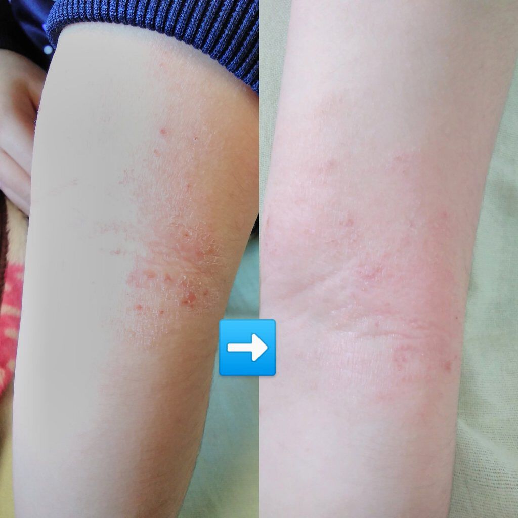 ファンチルフェイシャルソープ/HWANGCHIL/洗顔石鹸を使ったクチコミ(2枚目)