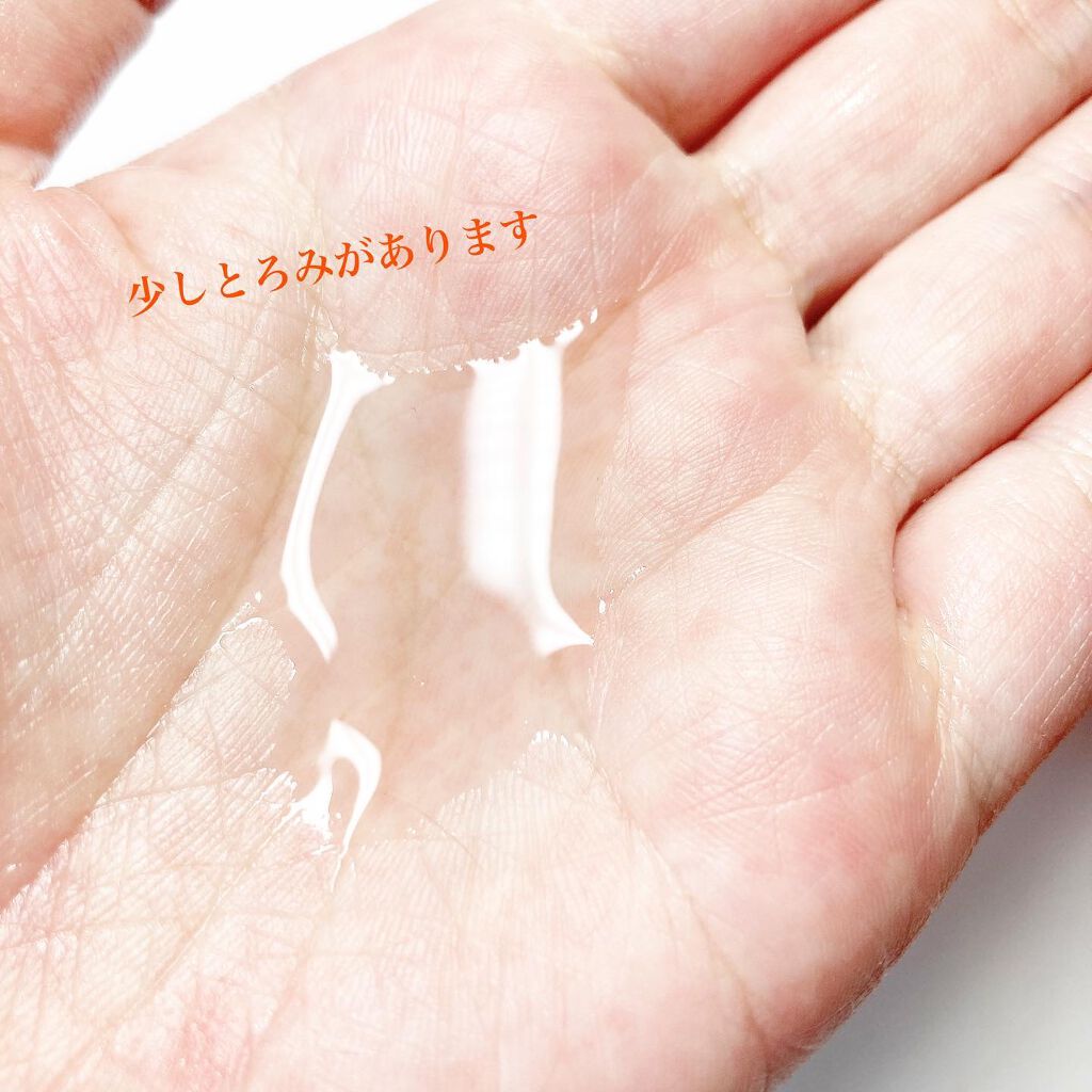 VC100エッセンスローション EX/ドクターシーラボⓇ/化粧水を使ったクチコミ（3枚目）