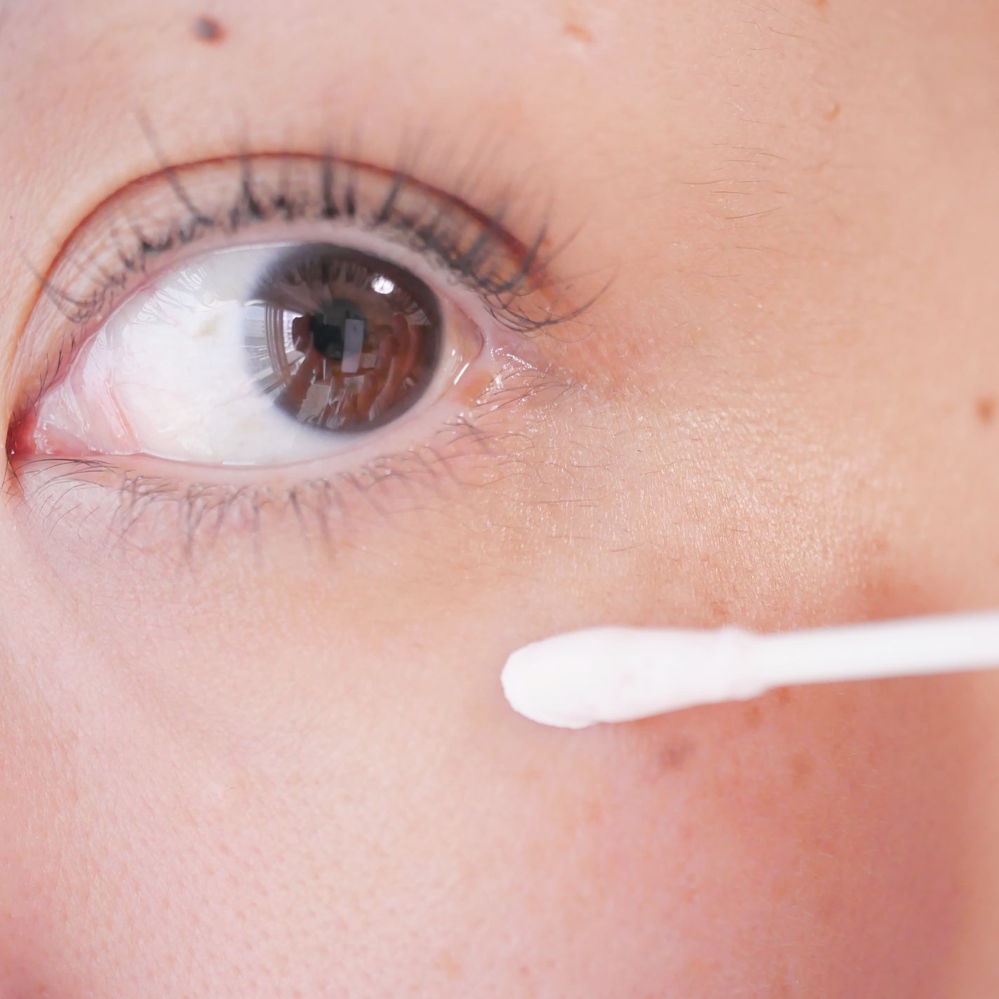 ピンクパウダースポットトリートメント/EUYIRA/その他スキンケアを使ったクチコミ(5枚目)