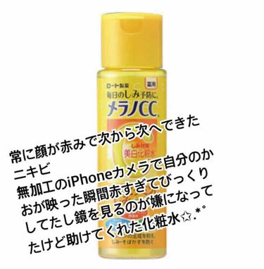 上に書いているような感じの肌で学校では鏡を見る度真っ赤で、、(´･ ･`)iPhoneカメラでも友達とうつると真っ赤で落ち込んでいました🙌🏽
次から次へと赤ニキビができてほっぺは真っ赤💧改善したいと思い