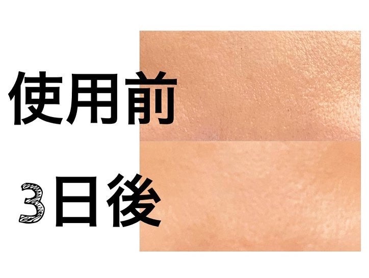 リードルショット100/VT/美容液を使ったクチコミ(4枚目)