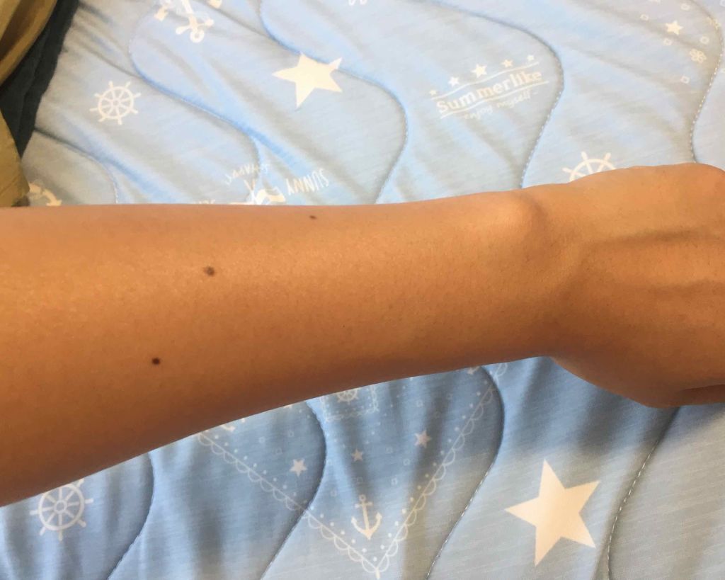 エバレッシュホワイトEXⅡ(医薬品)/matsukiyo/その他を使ったクチコミ(2枚目)