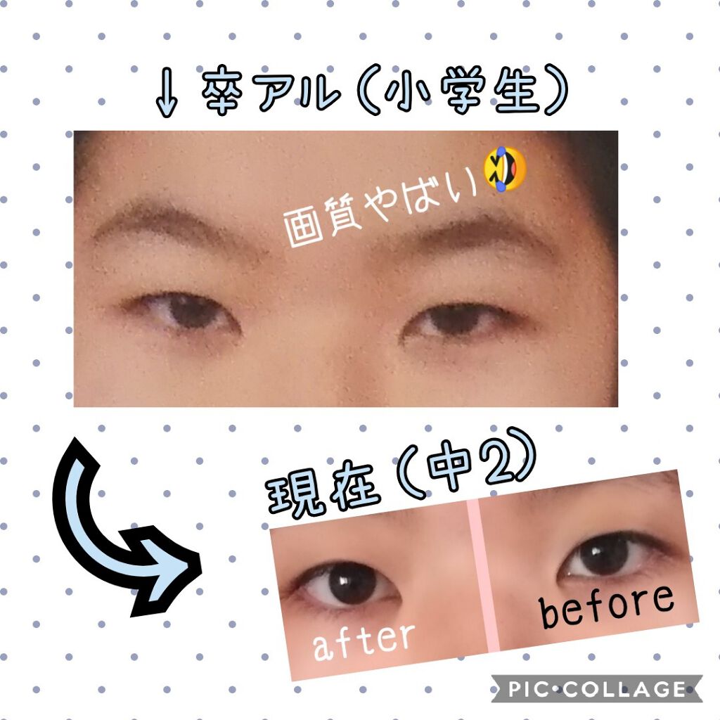 ニベアクリーム ニベアを使った口コミ こんにちは 先に言っておきますちょくち By ちょこ フォロー外してもいいです 10代前半 Lips