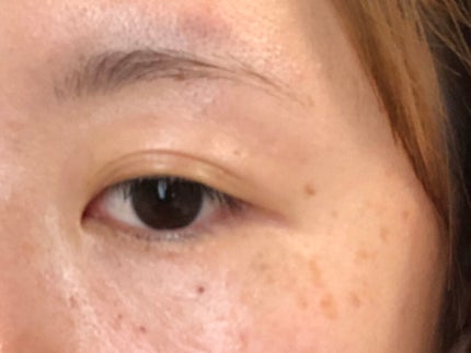 アイキララII/北の快適工房/アイケア・アイクリームを使ったクチコミ(5枚目)