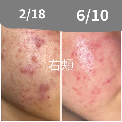 を使ったクチコミ(2枚目)