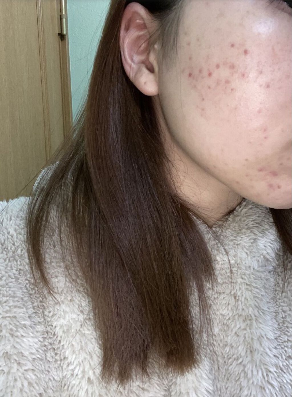 POWER　10　FORMULA　GF　EFFECTOR/It's skin/美容液を使ったクチコミ（1枚目）