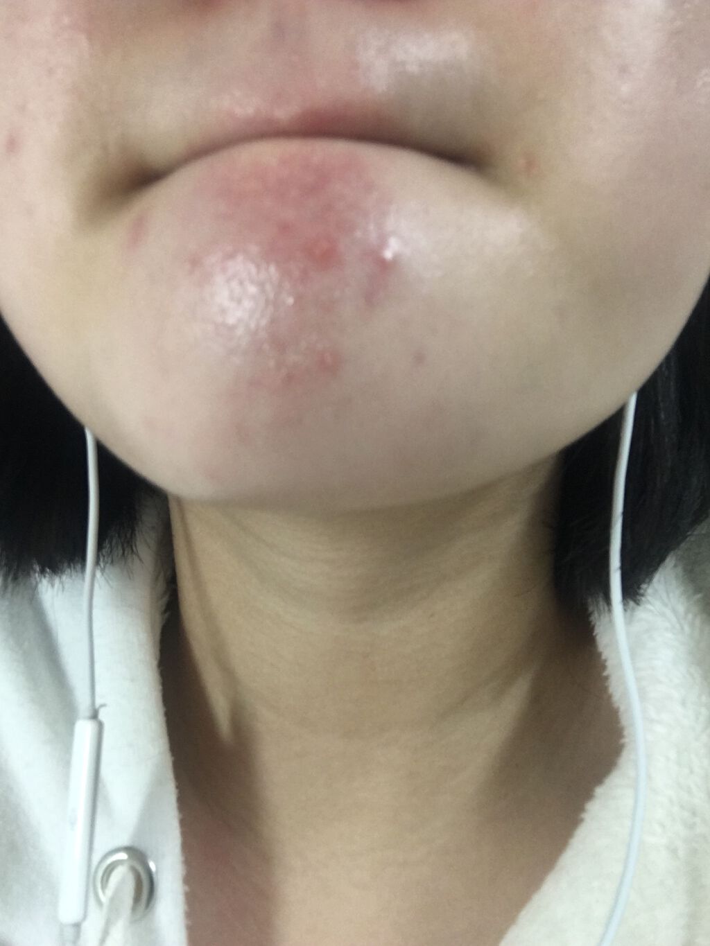 薬用スキンクリーム/オードムーゲ/フェイスクリームを使ったクチコミ(3枚目)