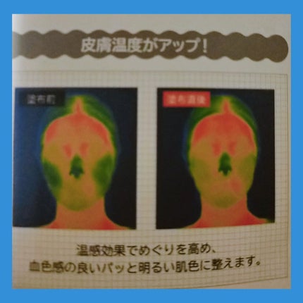 ヒートブースター /ESS/ブースター・導入液を使ったクチコミ(3枚目)